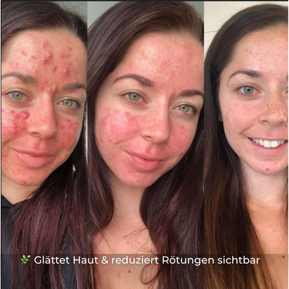 CÉLORA | Rohe Natur Heilcreme