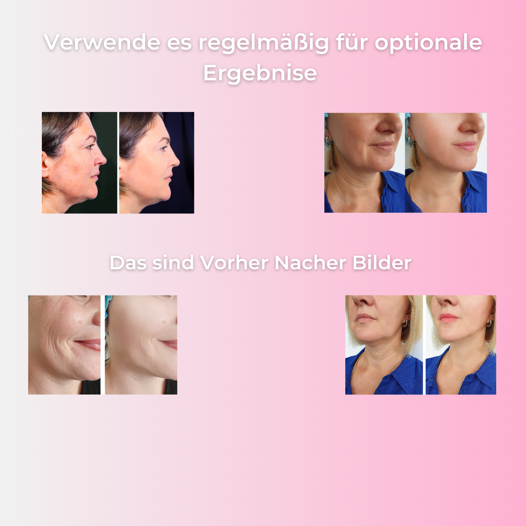 SkinLume Pro-Novative Lichttherapie für maximalen Effekt