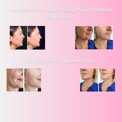 SkinLume Pro-Novative Lichttherapie für maximalen Effekt